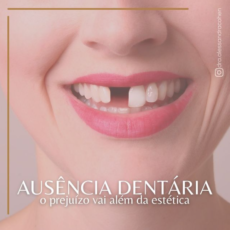 Ausência Dentária – O prejuízo vai além da estética