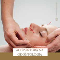 Acupuntura na Odontologia