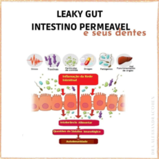 Leaky gut – Intestino permeável e seu dentes