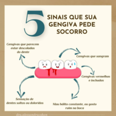 5 Sinais que sua gengiva pede socorro