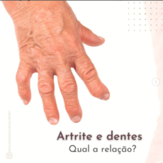 Artrite e dentes – Qual a relação?