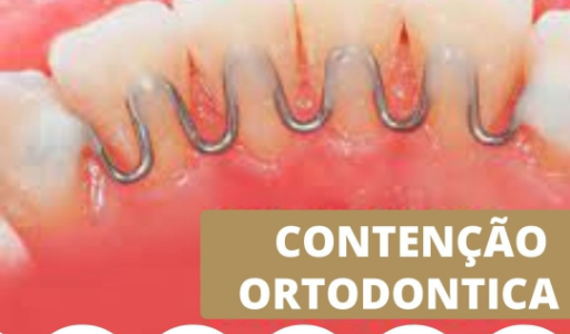 Contenção Ortodontica