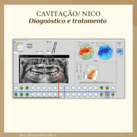 Cavitação / Nico: Diagnóstico e tratamento