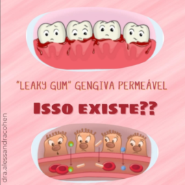 Leaky gum – Gengiva permeável – Isso existe??