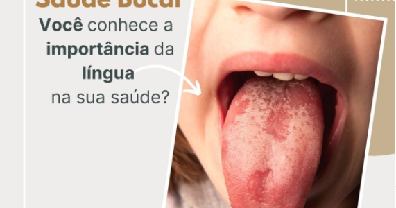 Saúde Bucal – Você conhece a importância da língua na sua saúde?